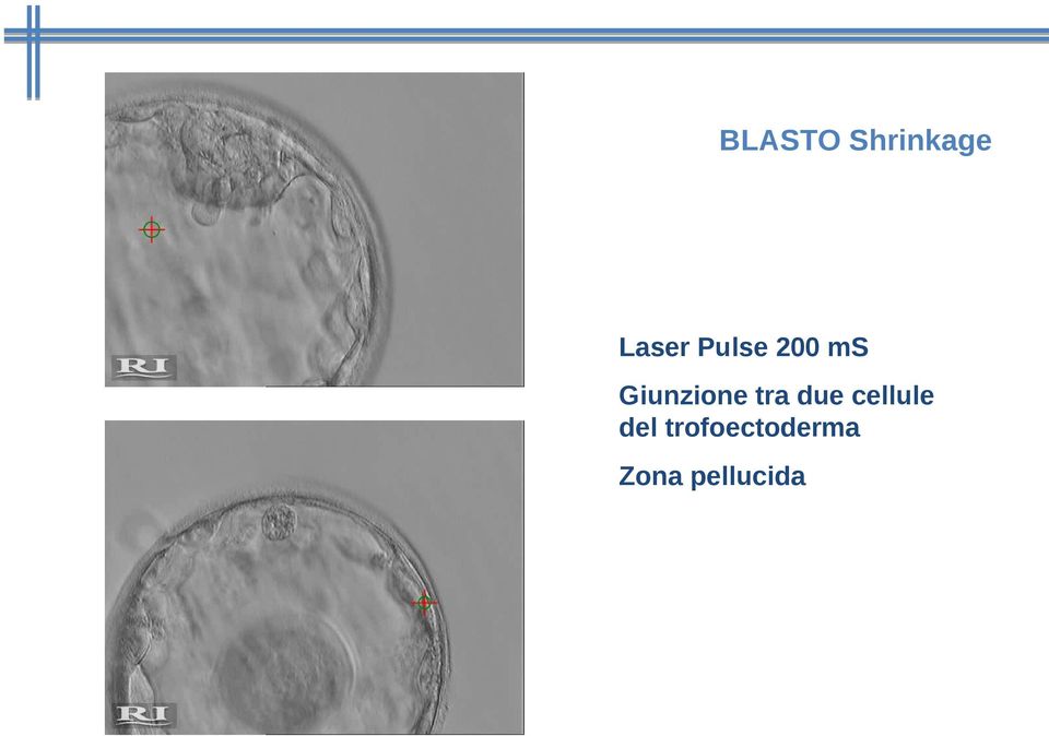 tra due cellule del