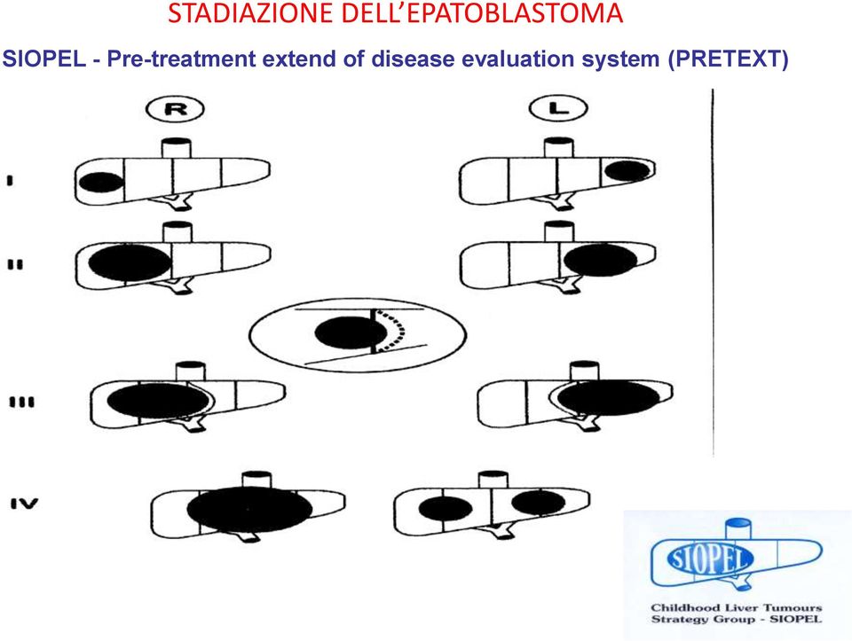 Pre-treatment extend of