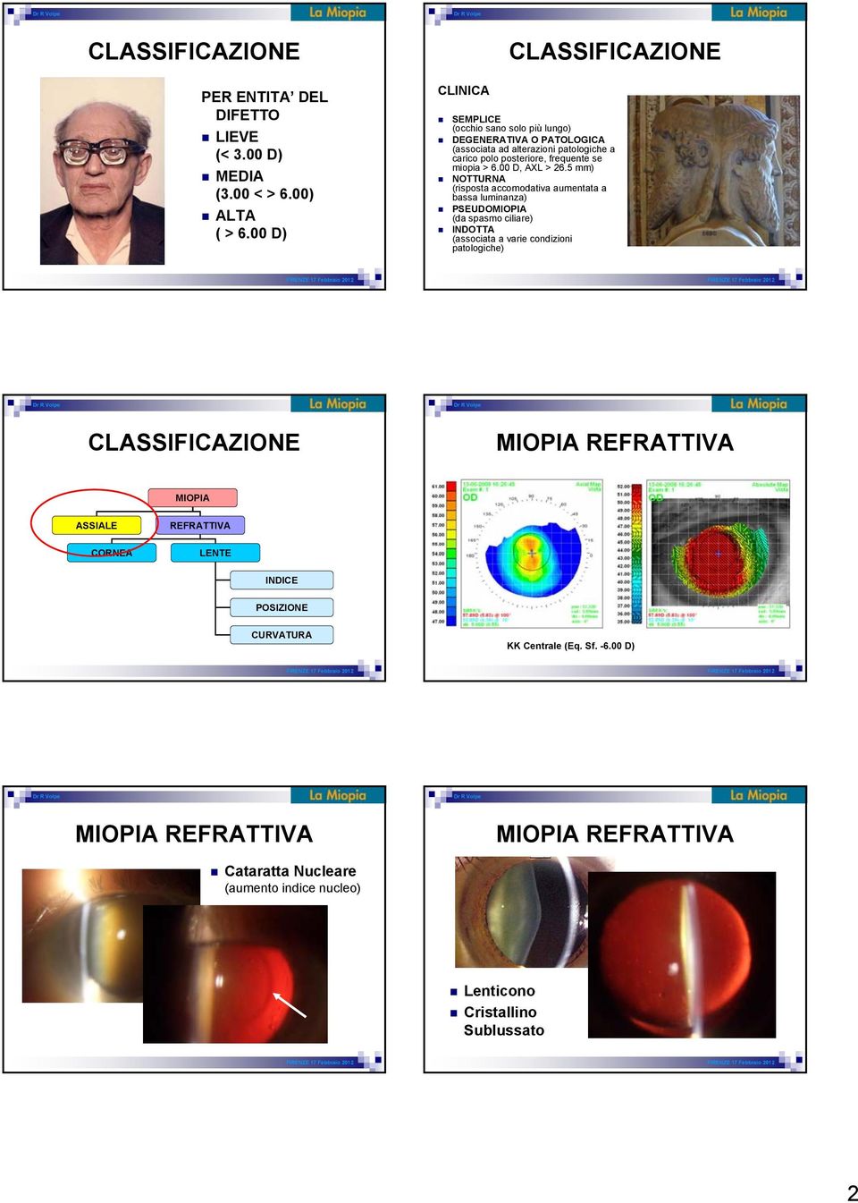 frequente se miopia > 6.00 D, AXL > 26.