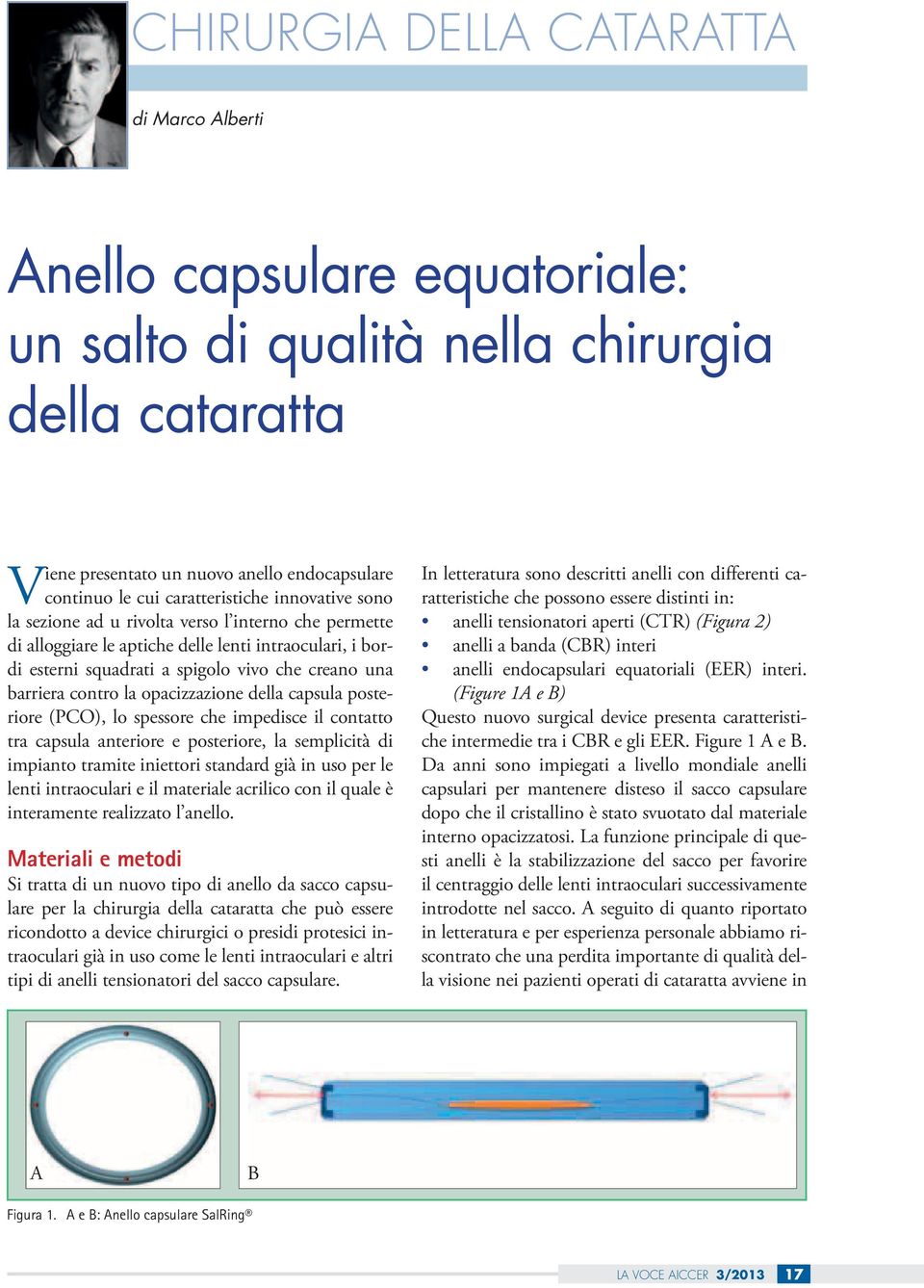 barriera contro la opacizzazione della capsula posteriore (PCO), lo spessore che impedisce il contatto tra capsula anteriore e posteriore, la semplicità di impianto tramite iniettori standard già in