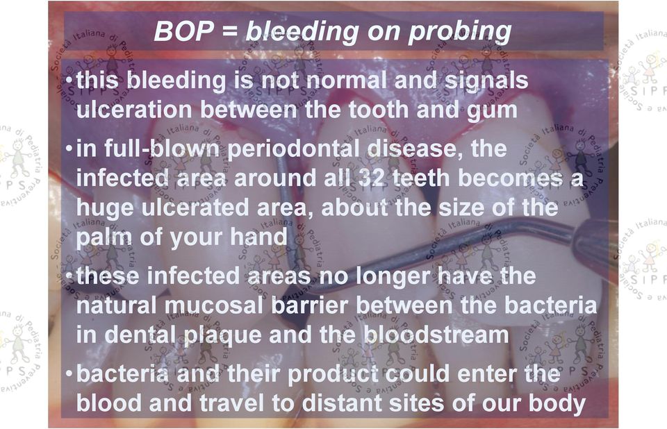 your hand these infected areas no longer have the natural mucosal barrier between the bacteria in dental