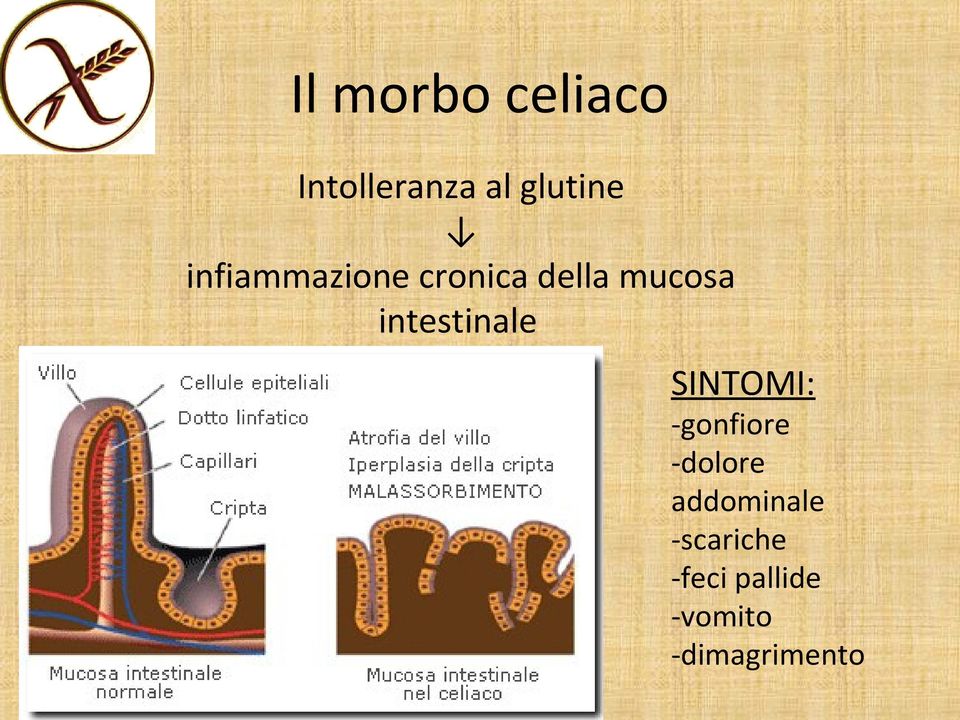 intestinale SINTOMI: -gonfiore -dolore