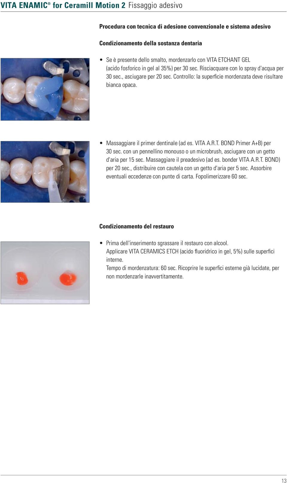 Massaggiare il primer dentinale (ad es. VITA A.R.T. BOND Primer A+B) per 30 sec. con un pennellino monouso o un microbrush, asciugare con un getto d'aria per 15 sec. Massaggiare il preadesivo (ad es.