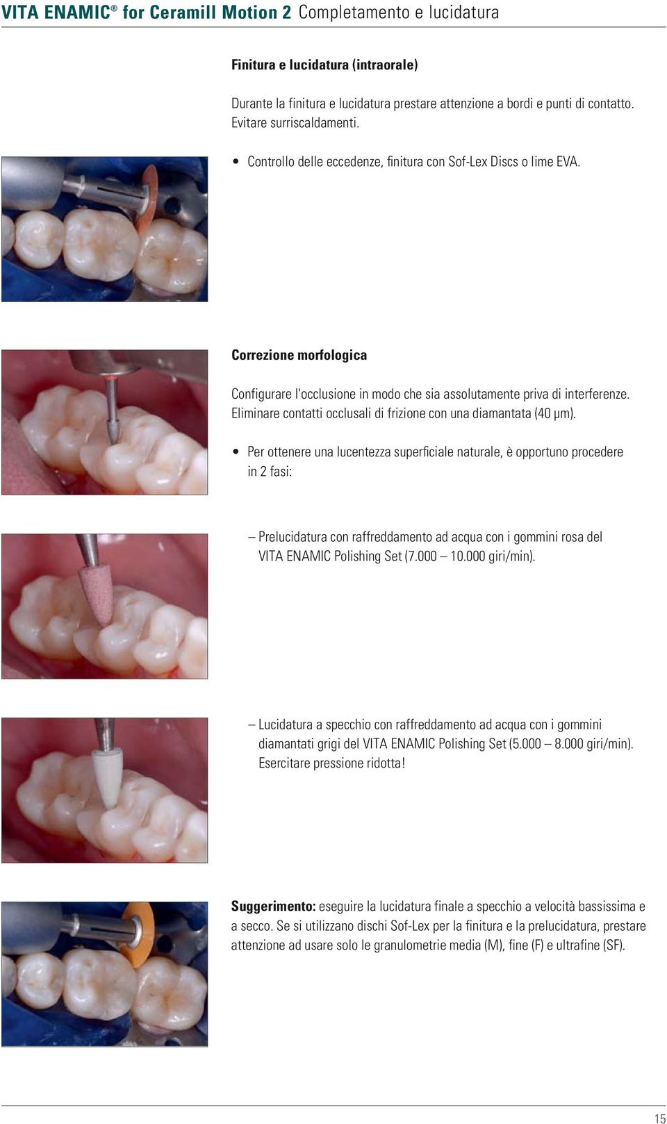 Eliminare contatti occlusali di frizione con una diamantata (40 µm).