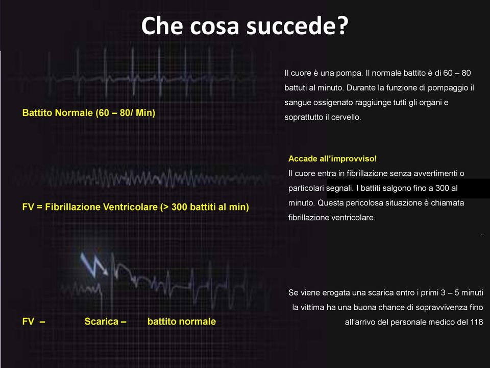 FV = Fibrillazione Ventricolare (> 300 battiti al min) Accade all improvviso! Il cuore entra in fibrillazione senza avvertimenti o particolari segnali.