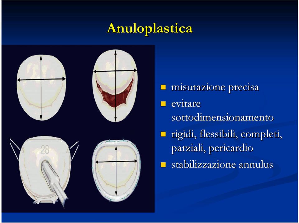 rigidi, flessibili, completi,