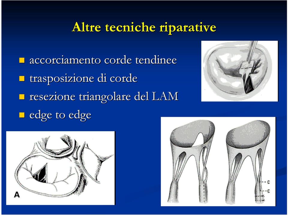 trasposizione di corde