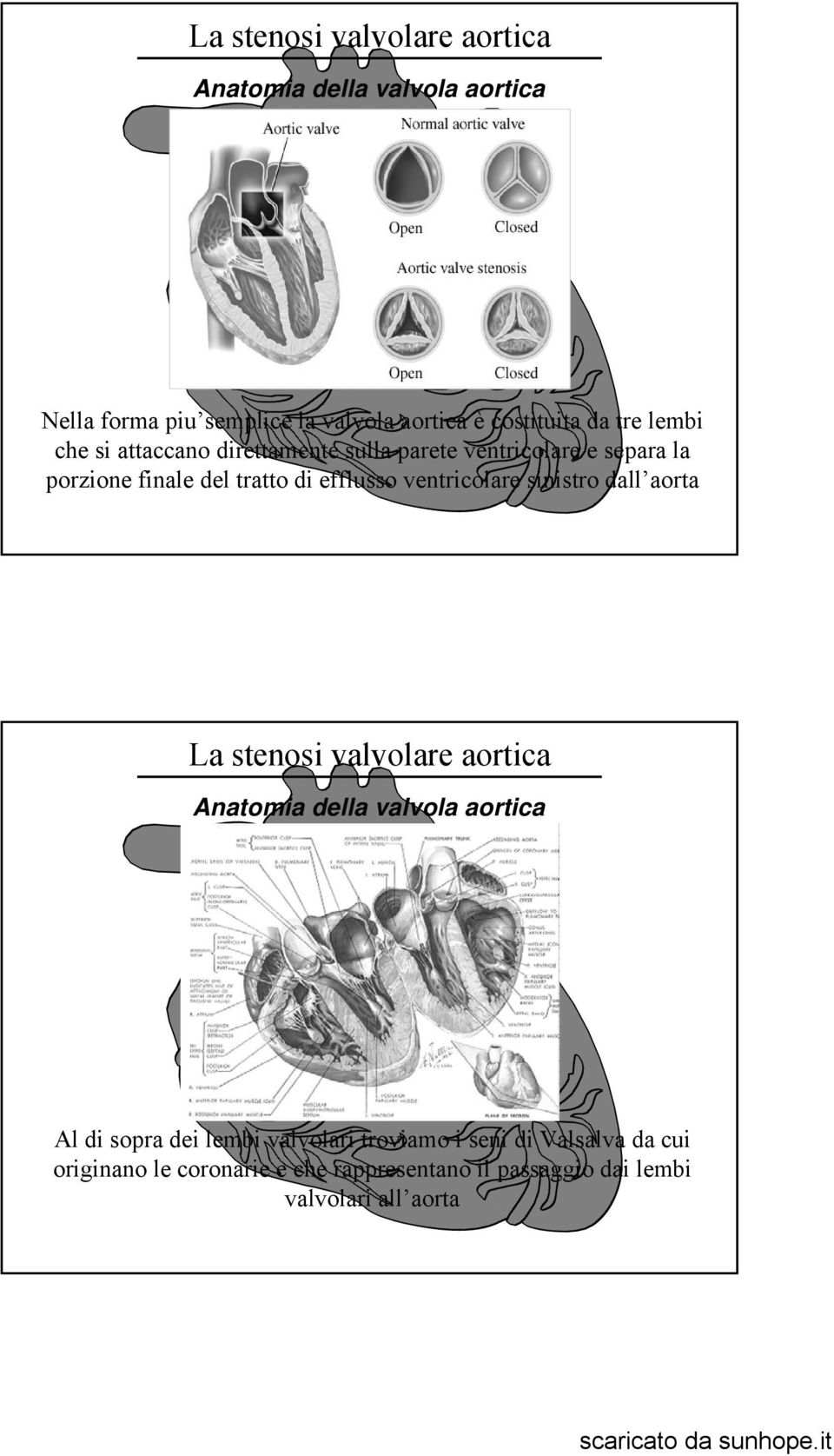 ventricolare sinistro dall aorta Anatomia della valvola aortica Al di sopra dei lembi valvolari troviamo