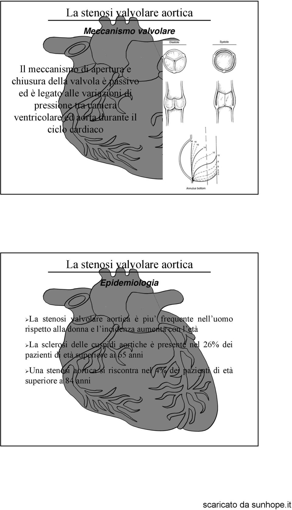 rispetto alla donna e l incidenza aumenta con l età La sclerosi delle cuspidi aortiche è presente nel 26% dei