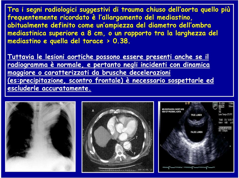 quella del torace > 0.38.