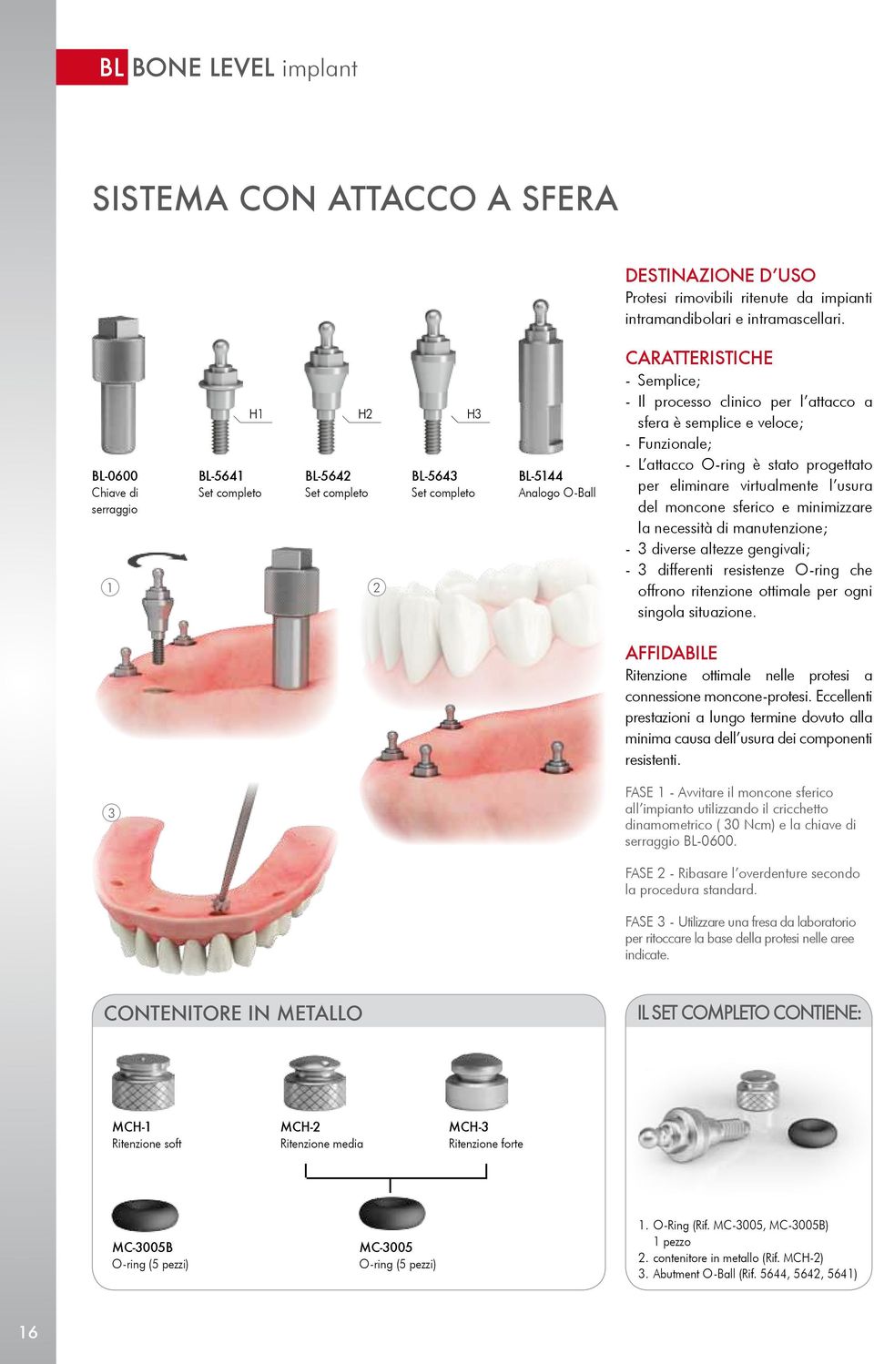 caratteristiche - Semplice; - Il processo clinico per l attacco a sfera è semplice e veloce; - Funzionale; - L attacco O-ring è stato progettato per eliminare virtualmente l usura del moncone sferico