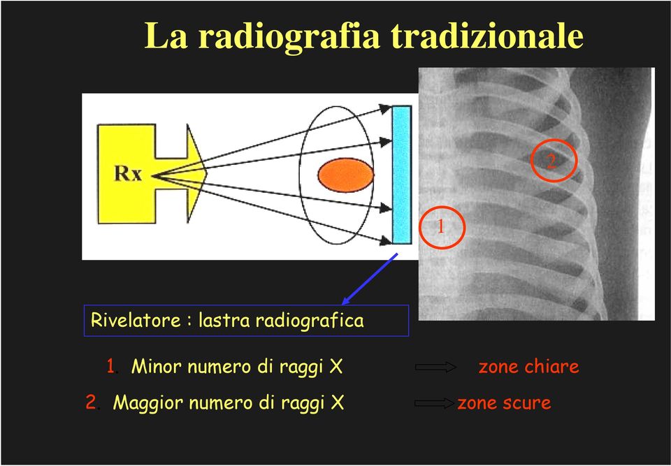 Minor numero di raggi X zone chiare