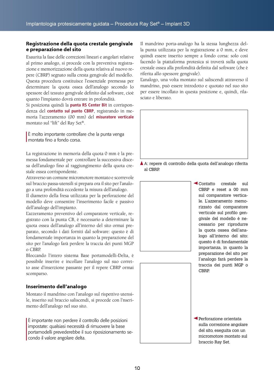 Questa procedura costituisce l essenziale premessa per determinare la quota ossea dell analogo secondo lo spessore del tessuto gengivale definito dal software, cioè quanto l impianto dovrà entrare in