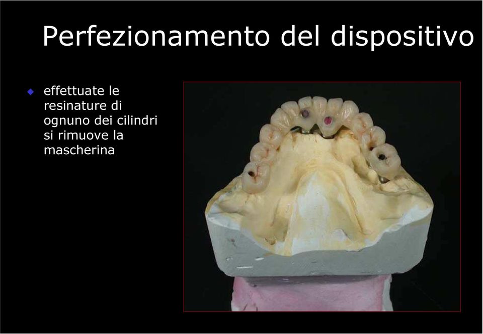 resinature di ognuno dei