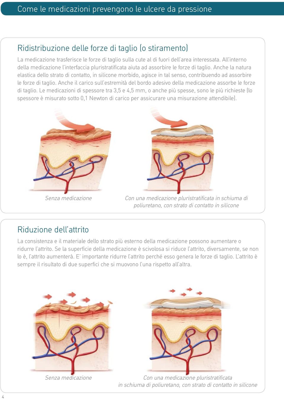 Anche la natura elastica dello strato di contatto, in silicone morbido, agisce in tal senso, contribuendo ad assorbire le forze di taglio.