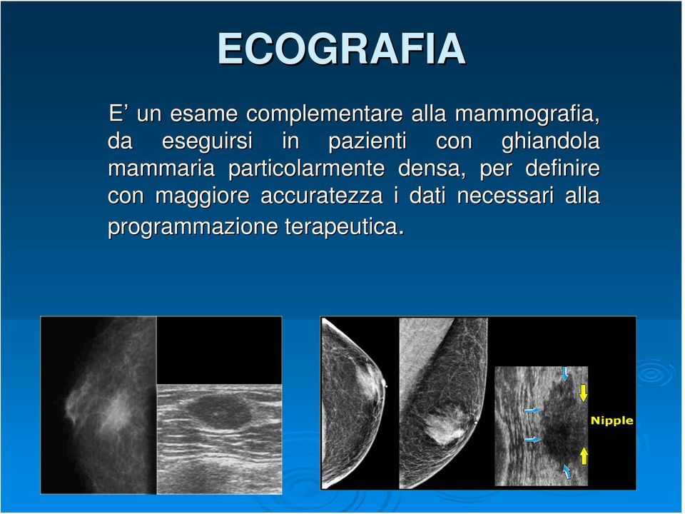 particolarmente densa, per definire con maggiore