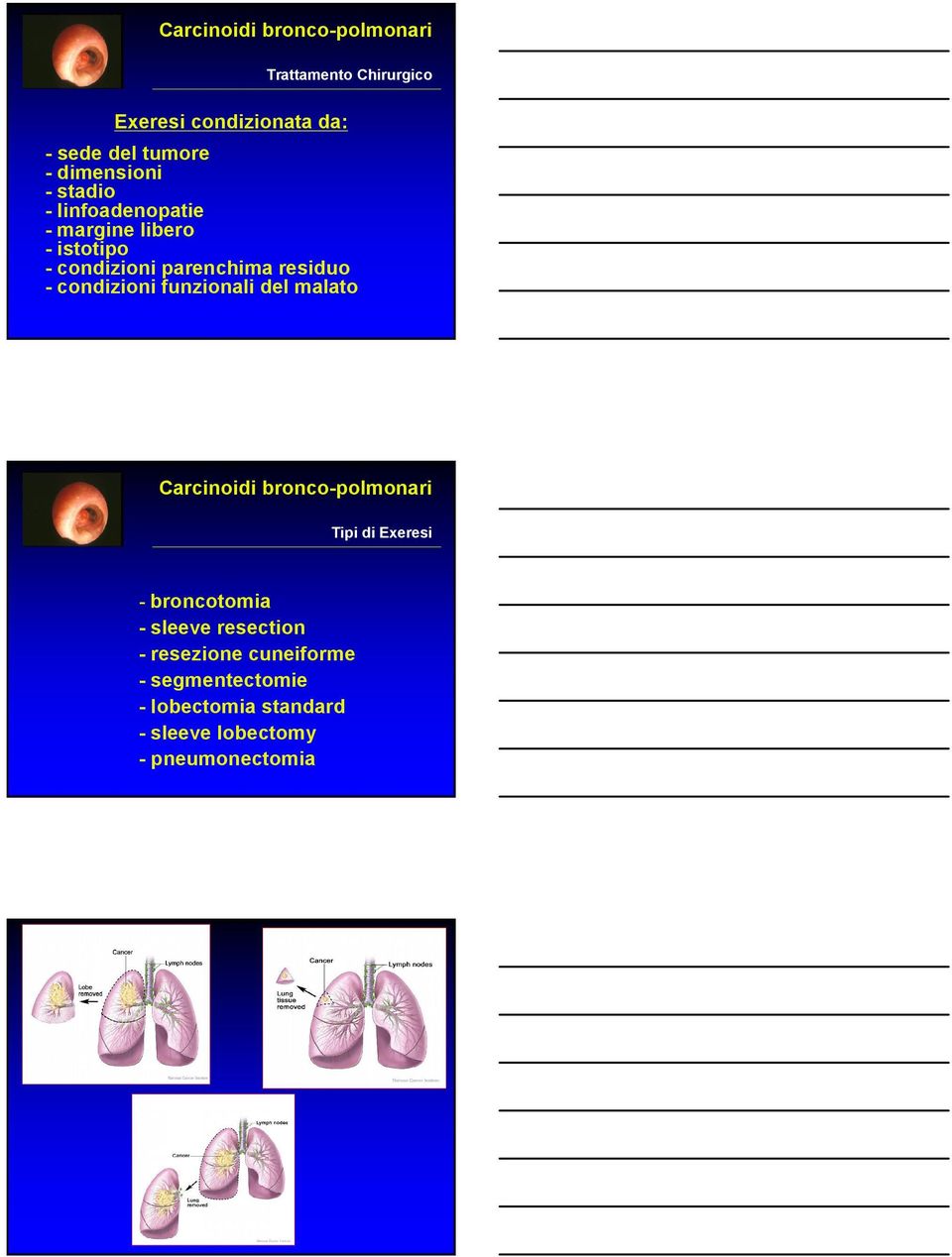 condizioni funzionali del malato Tipi di Exeresi - broncotomia - sleeve resection -