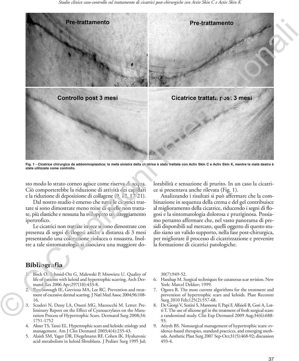 C IC Ed iz io sto modo lo strato corneo agisce come riserva di acqua. Ciò comporterebbe la riduzione di attività dei capillari e la riduzione di deposizione di collagene (9, 12, 17-21).