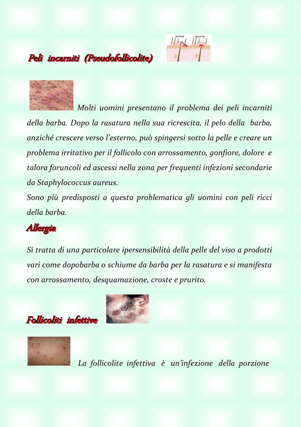 dolore e talora foruncoli ed ascessi nella zona per frequenti infezioni secondarie da Staphylococcus aureus. Sono più predisposti a questa problematica gli uomini con peli ricci della barba.