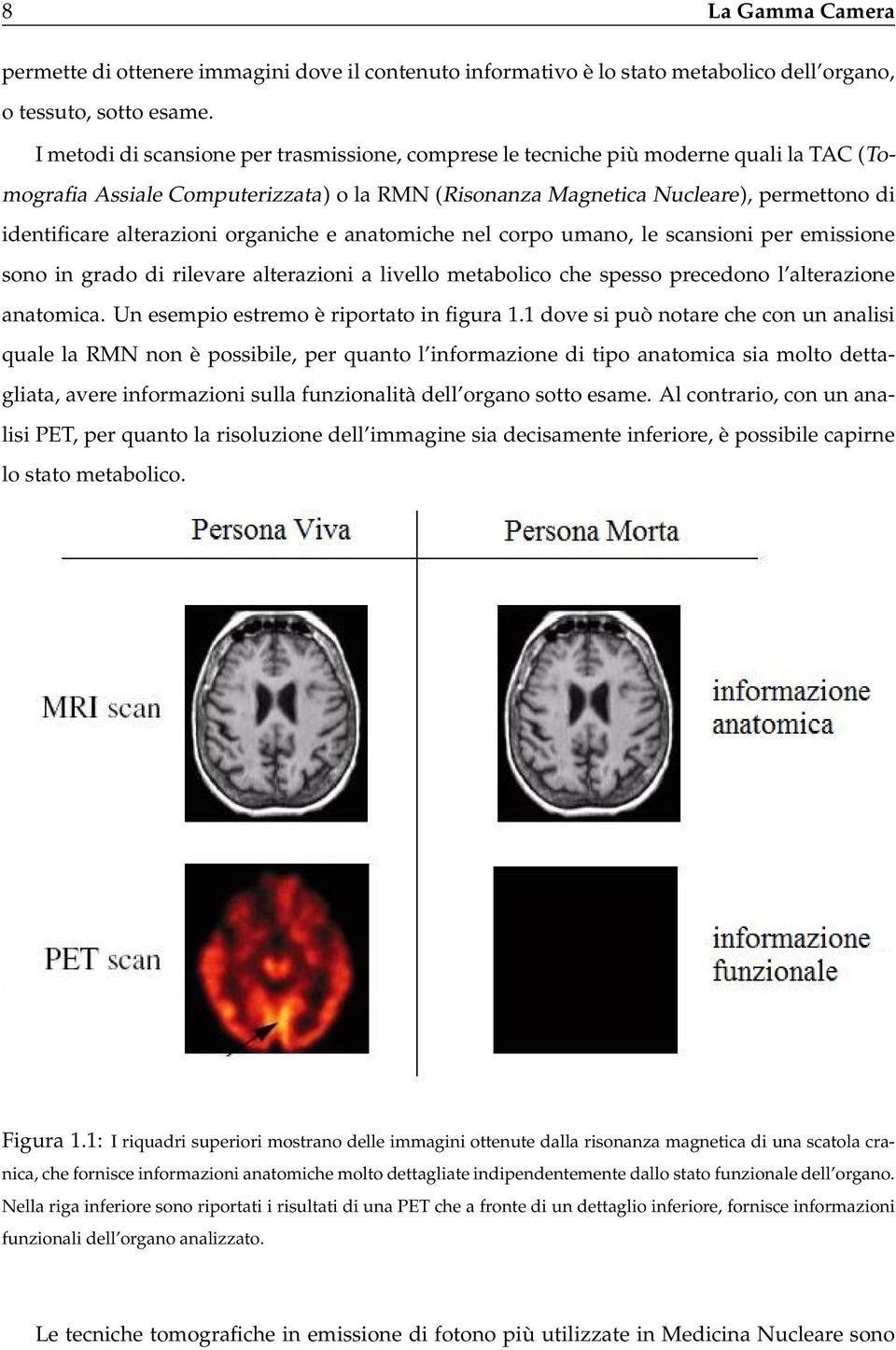 alterazioni organiche e anatomiche nel corpo umano, le scansioni per emissione sono in grado di rilevare alterazioni a livello metabolico che spesso precedono l alterazione anatomica.