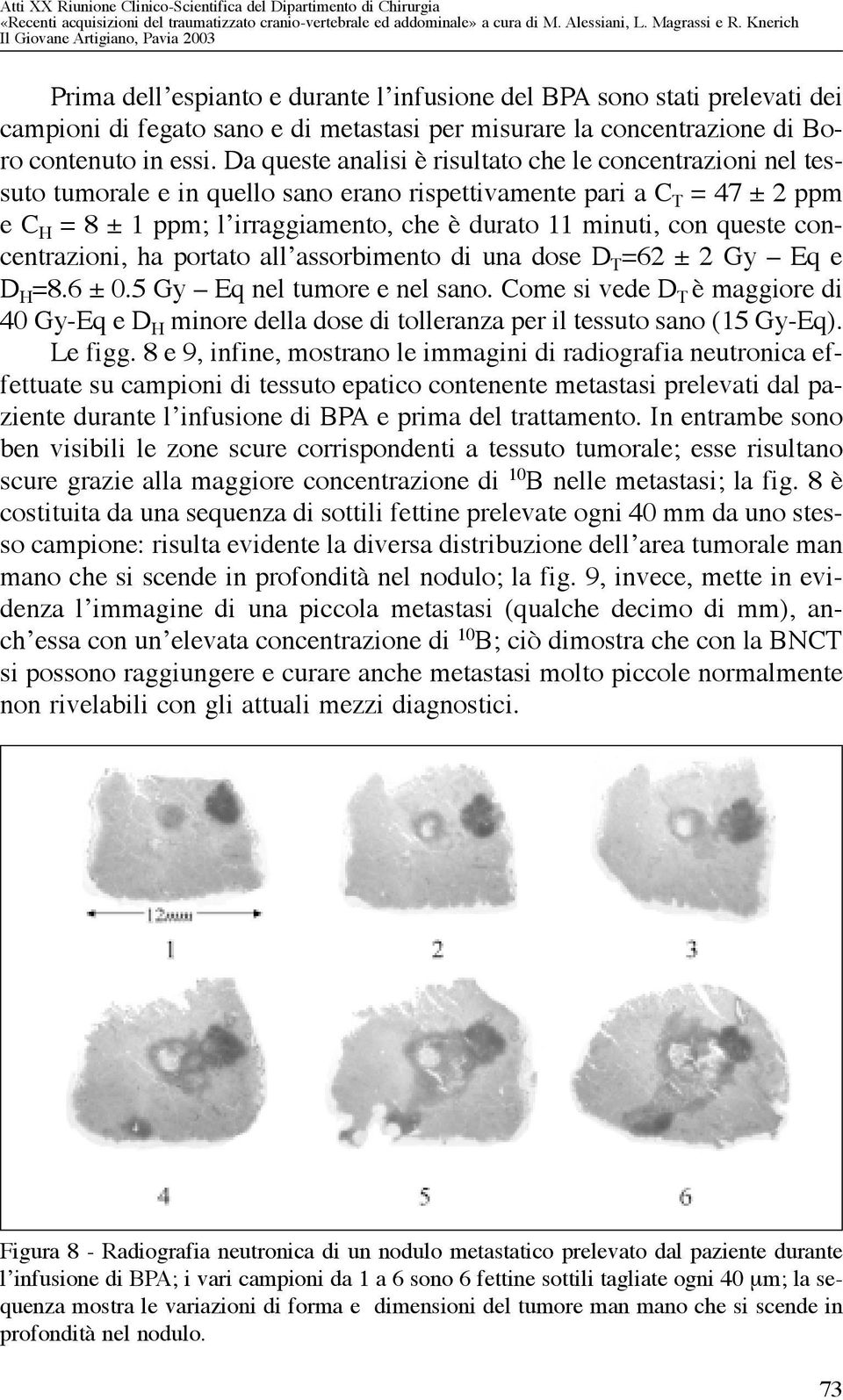 queste concentrazioni, ha portato all assorbimento di una dose D T =62 ± 2 Gy Eq e D H =8.6 ± 0.5 Gy Eq nel tumore e nel sano.