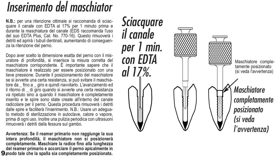 Questo rimuoverà i detriti ed aprirà i tubuli dentinali, aumentando di conseguenza la ritenzione del perno.