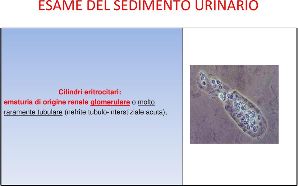 renale glomerulare o molto raramente