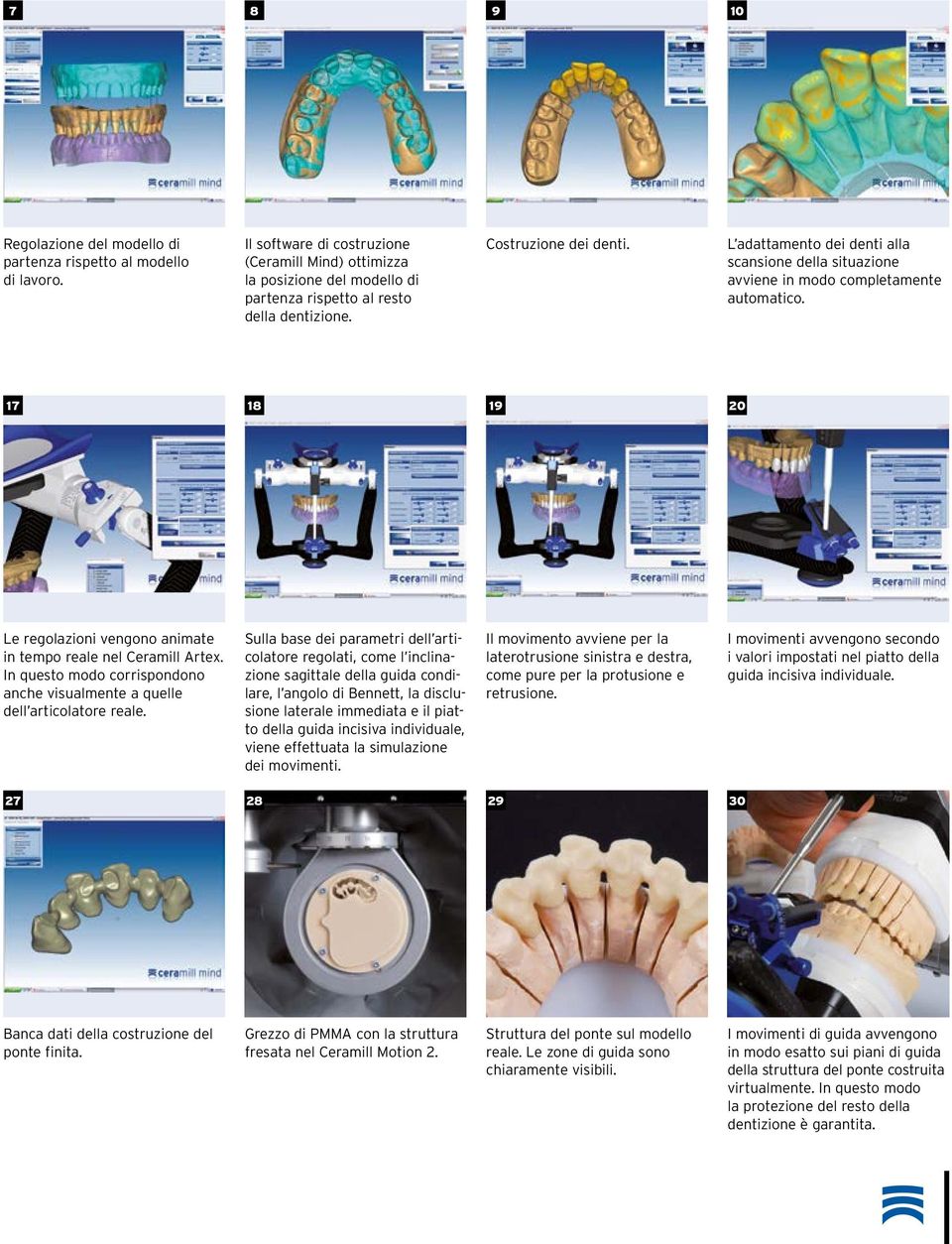 L adattamento dei denti alla scansione della situazione avviene in modo completamente automatico. 17 18 19 20 Le regolazioni vengono animate in tempo reale nel Ceramill Artex.