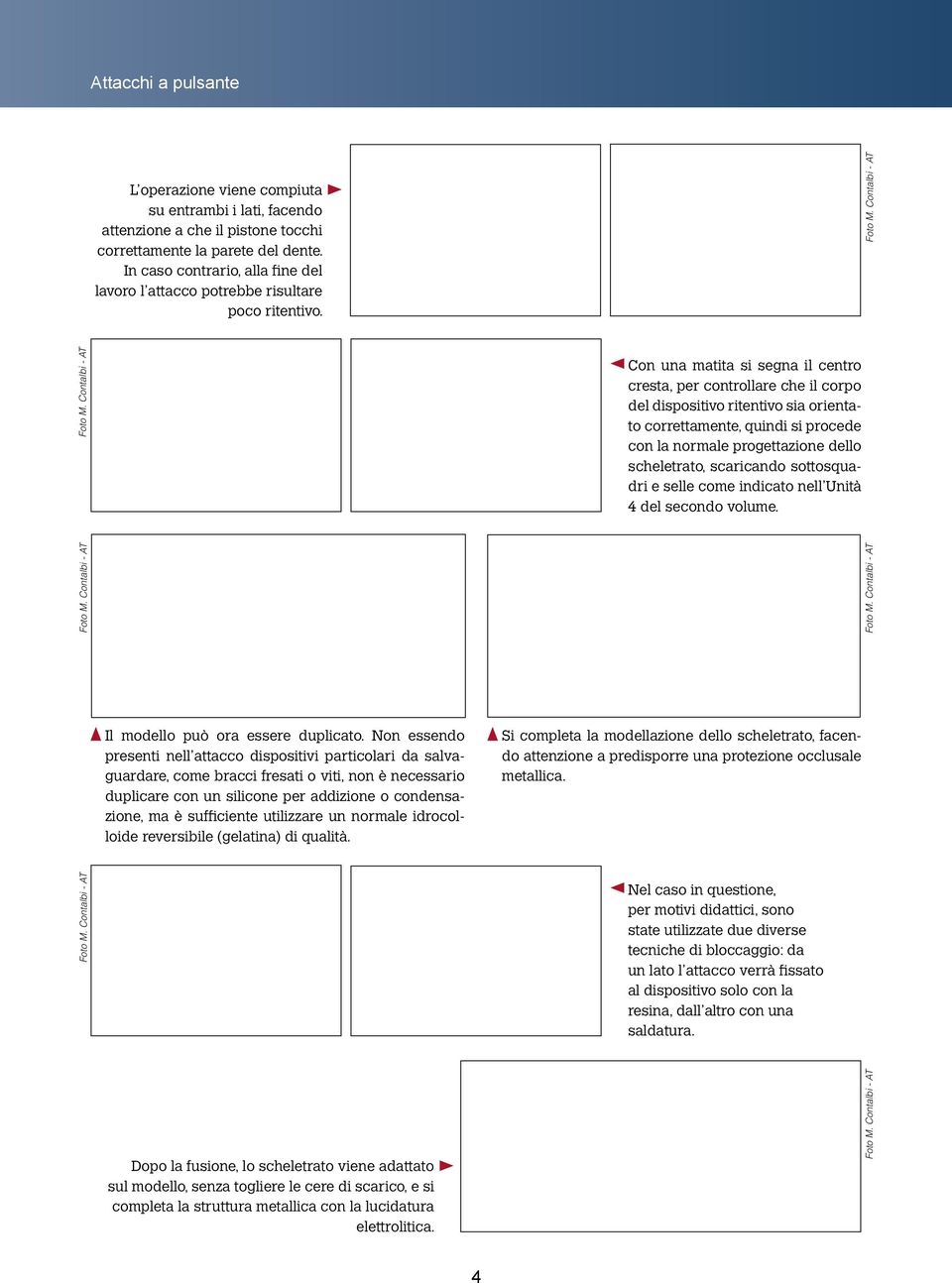 Con una matita si segna il centro cresta, per controllare che il corpo del dispositivo ritentivo sia orientato correttamente, quindi si procede con la normale progettazione dello scheletrato,