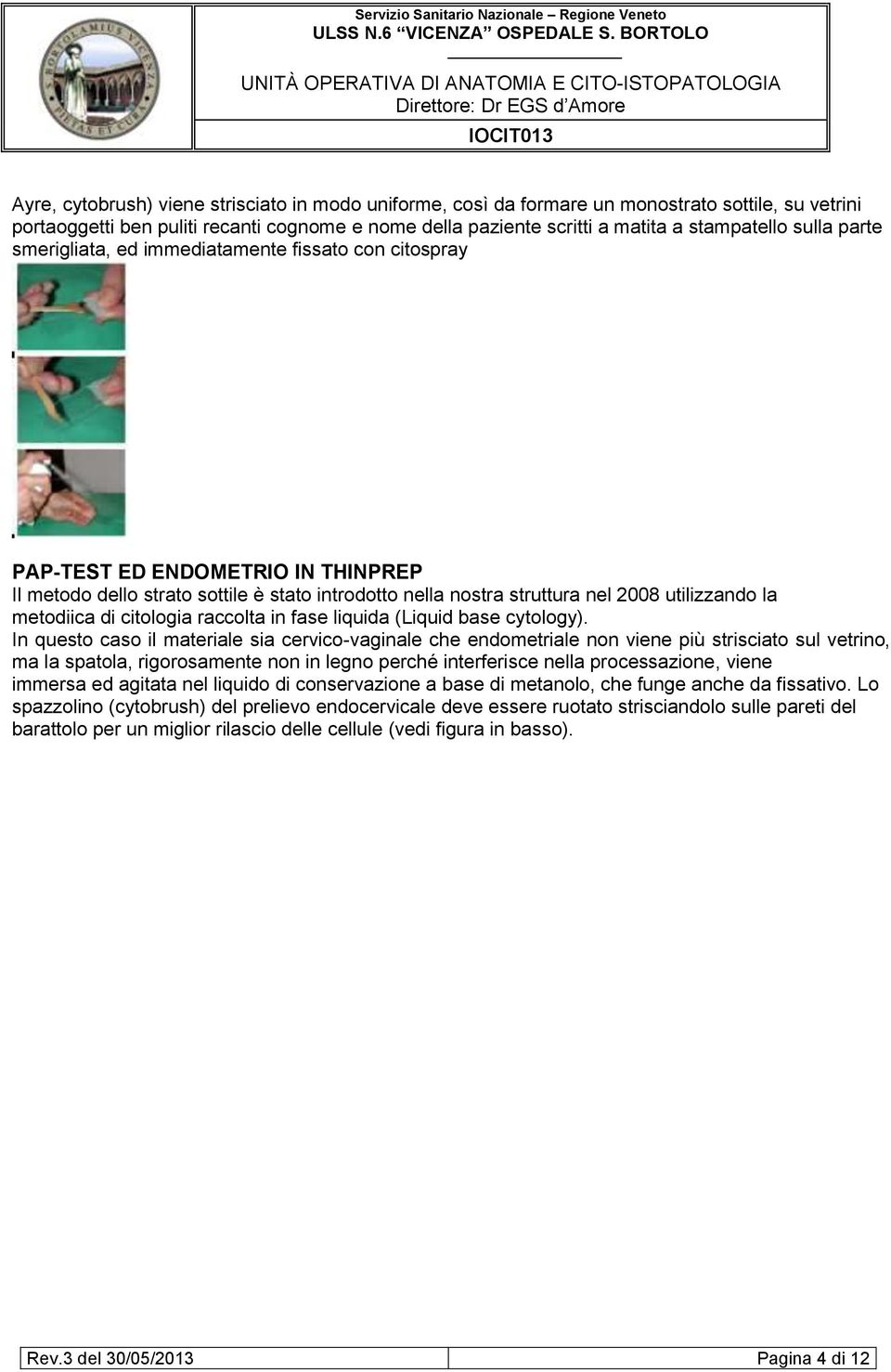 metodiica di citologia raccolta in fase liquida (Liquid base cytology).