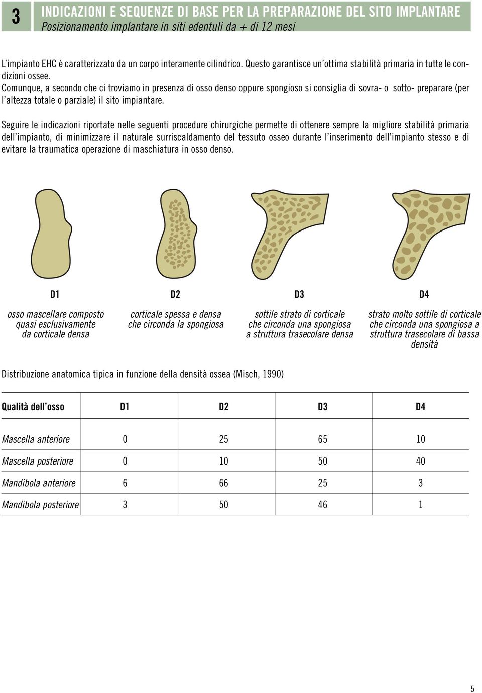 Comunque, a secondo che ci troviamo in presenza di osso denso oppure spongioso si consiglia di sovra- o sotto- preparare (per l altezza totale o parziale) il sito impiantare.