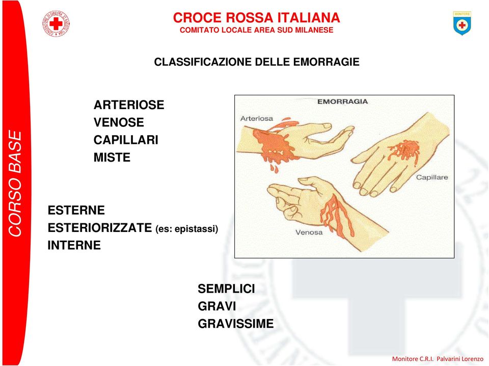 ESTERNE ESTERIORIZZATE (es: