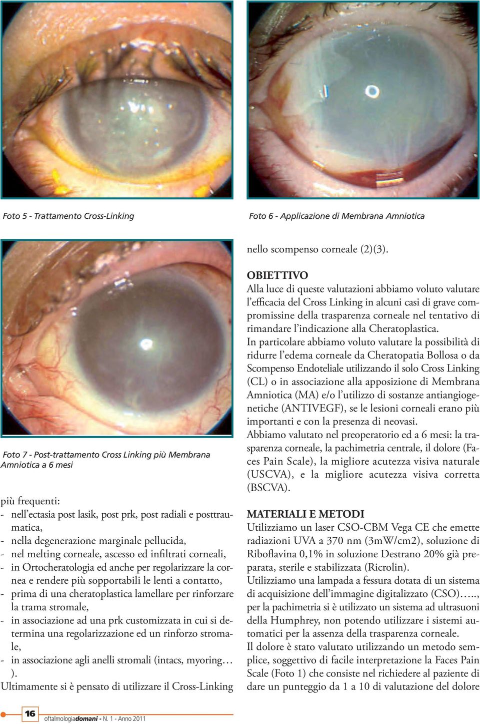 nel melting corneale, ascesso ed infiltrati corneali, - in Ortocheratologia ed anche per regolarizzare la cornea e rendere più sopportabili le lenti a contatto, - prima di una cheratoplastica