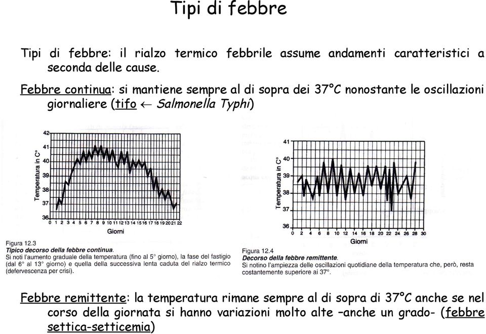 Febbre continua: si mantiene sempre al di sopra dei 37 C nonostante le oscillazioni giornaliere (tifo