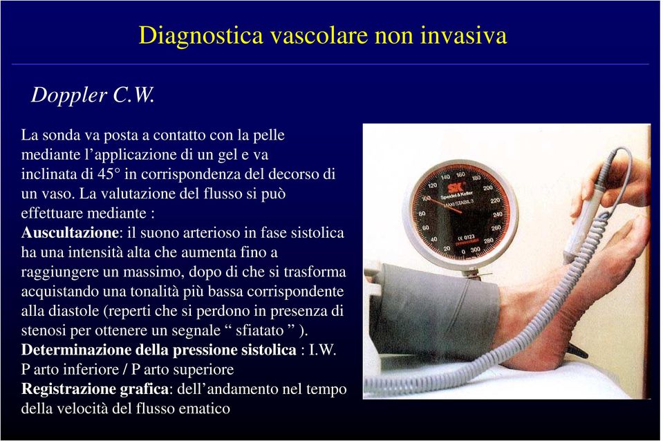 La valutazione del flusso si può effettuare mediante : Auscultazione: il suono arterioso in fase sistolica ha una intensità alta che aumenta fino a raggiungere un massimo,