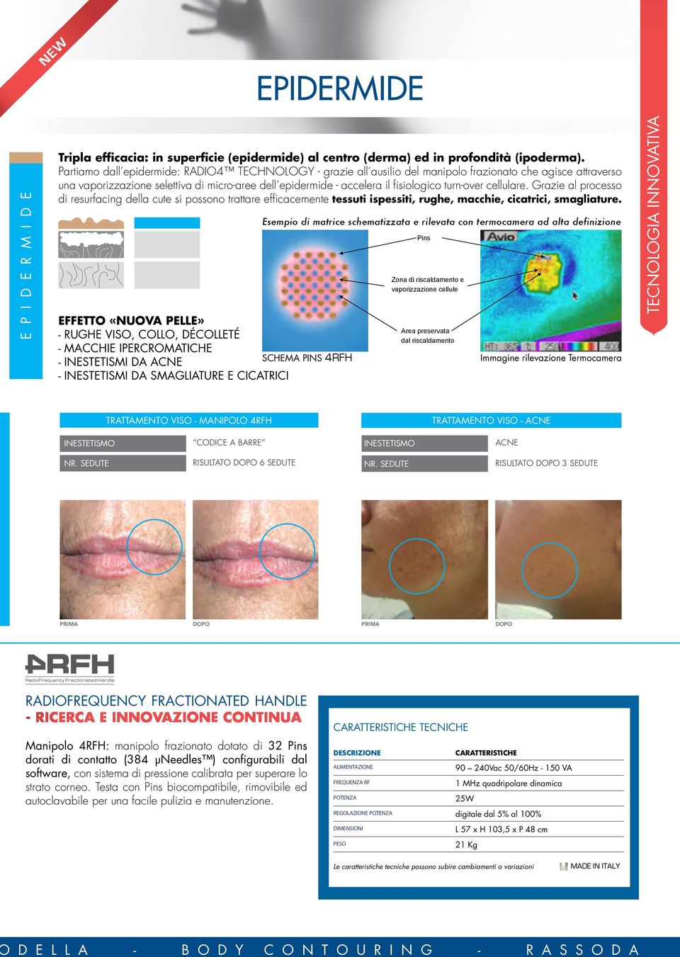 turn-over cellulare. Grazie al processo di resurfacing della cute si possono trattare efficacemente tessuti ispessiti, rughe, macchie, cicatrici, smagliature.