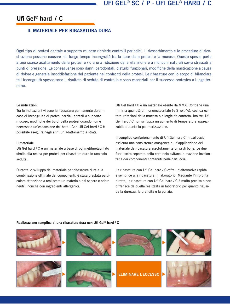 Questo spesso porta a uno scarso adattamento della protesi e / o a una riduzione della ritenzione e a monconi naturali sovra stressati e punti di pressione.