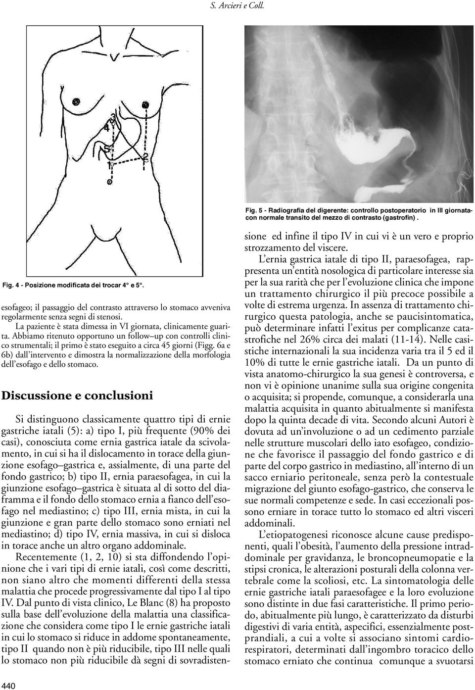 Abbiamo ritenuto opportuno un follow up con controlli clinico strumentali; il primo è stato eseguito a circa 45 giorni (Figg.