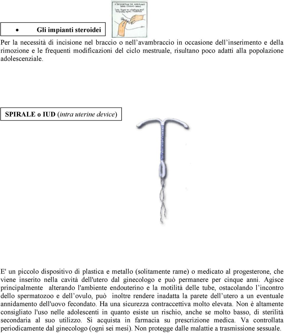 SPIRALE o IUD (intra uterine device) E' un piccolo dispositivo di plastica e metallo (solitamente rame) o medicato al progesterone, che viene inserito nella cavità dell'utero dal ginecologo e può