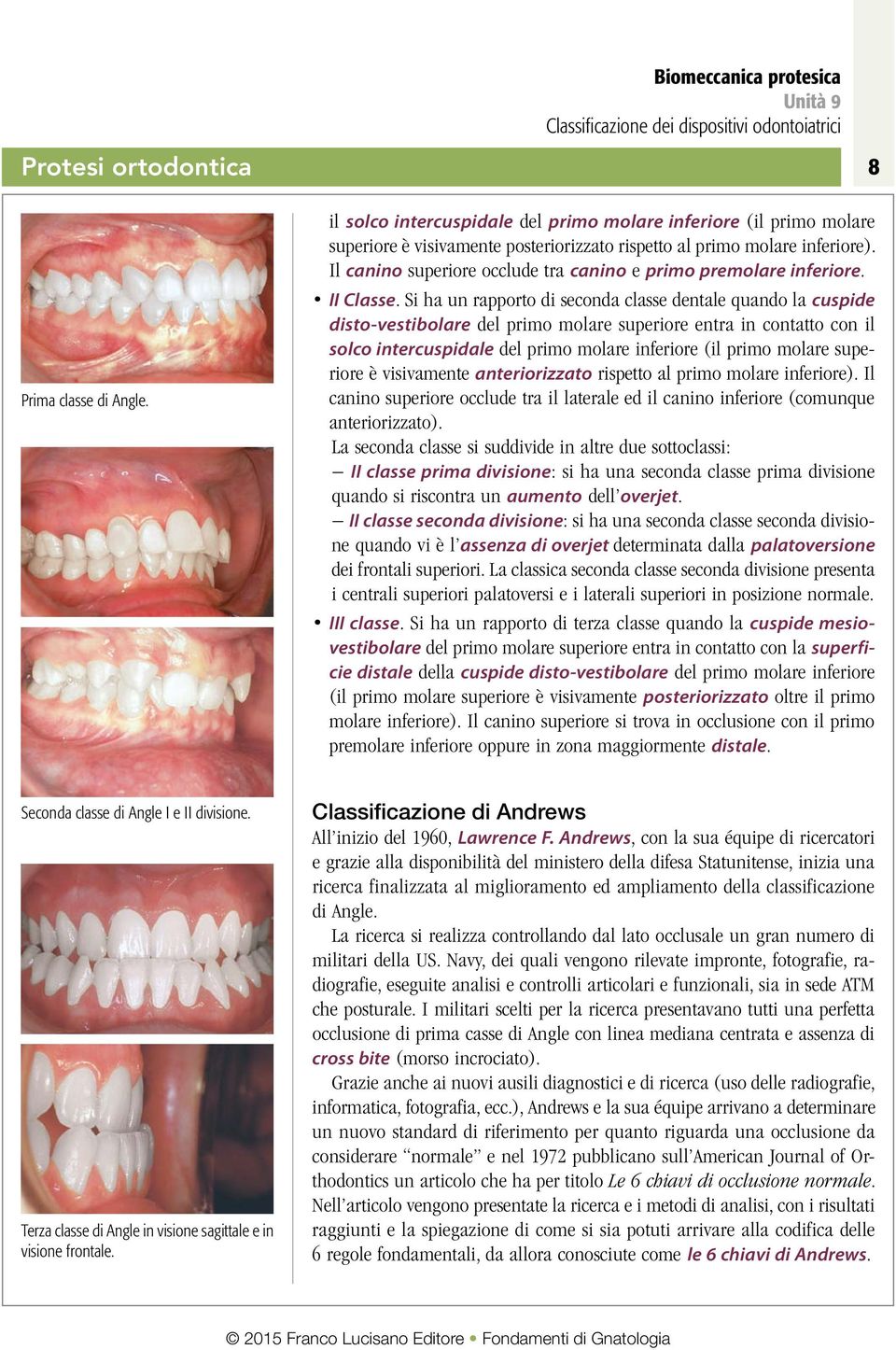 Si ha un rapporto di seconda classe dentale quando la cuspide disto-vestibolare del primo molare superiore entra in contatto con il solco intercuspidale del primo molare inferiore (il primo molare