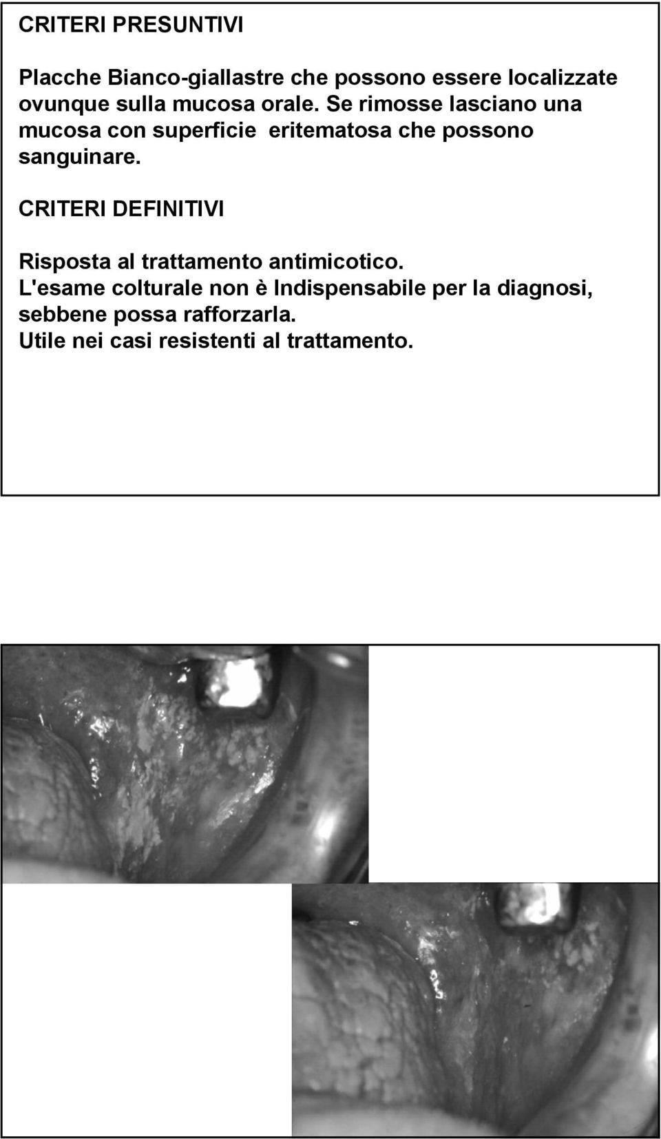 Se rimosse lasciano una mucosa con superficie eritematosa che possono sanguinare.