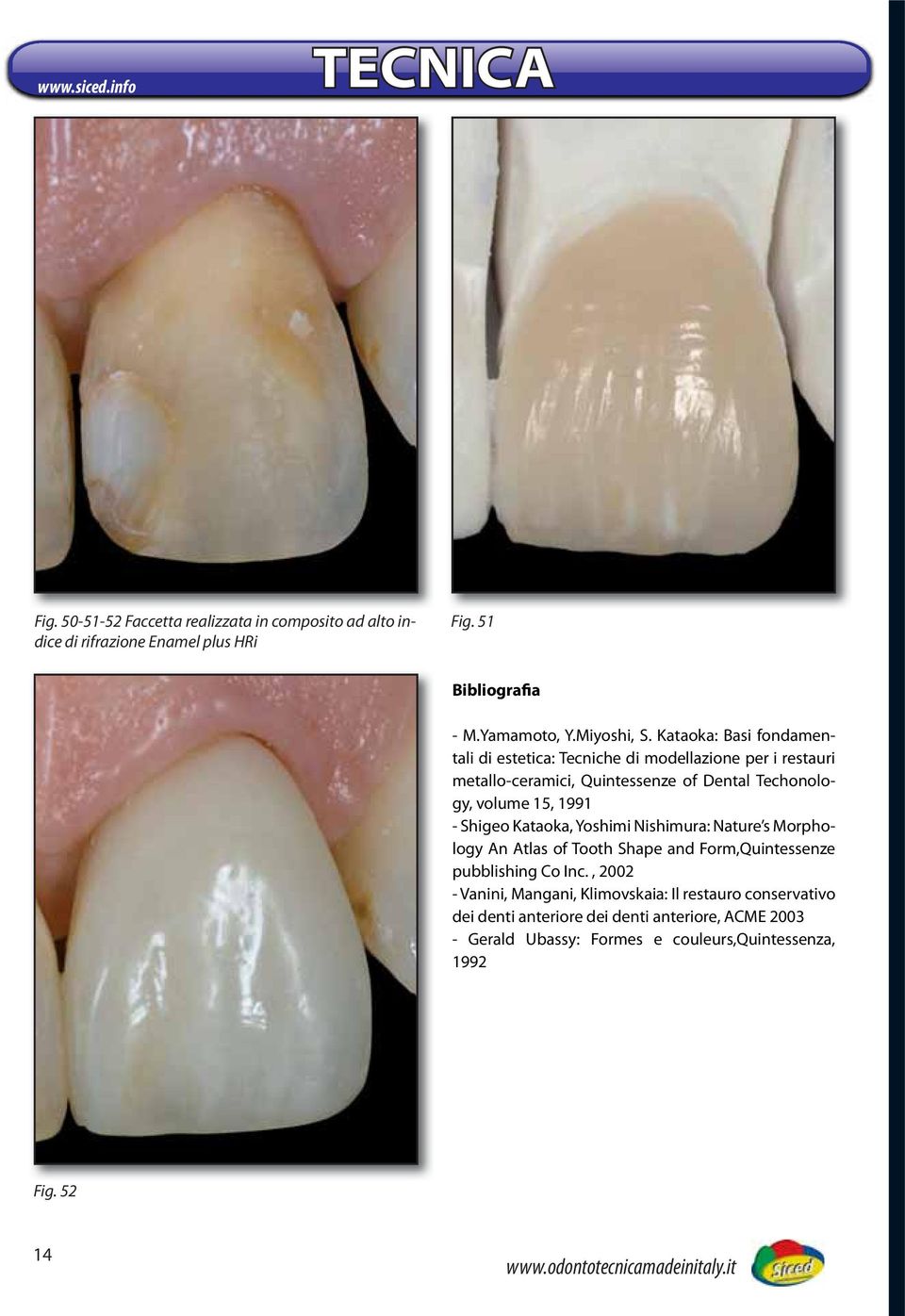 Kataoka: Basi fondamentali di estetica: Tecniche di modellazione per i restauri metallo-ceramici, Quintessenze of Dental Techonology, volume 15, 1991 -