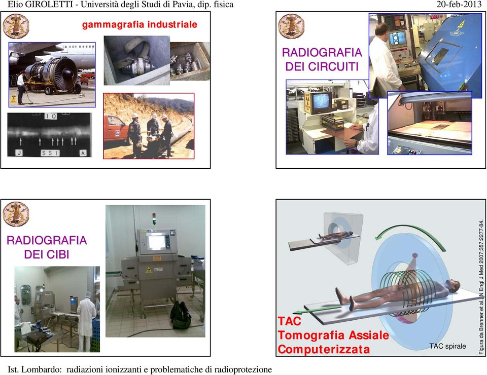 Tomografia Assiale Computerizzata TAC