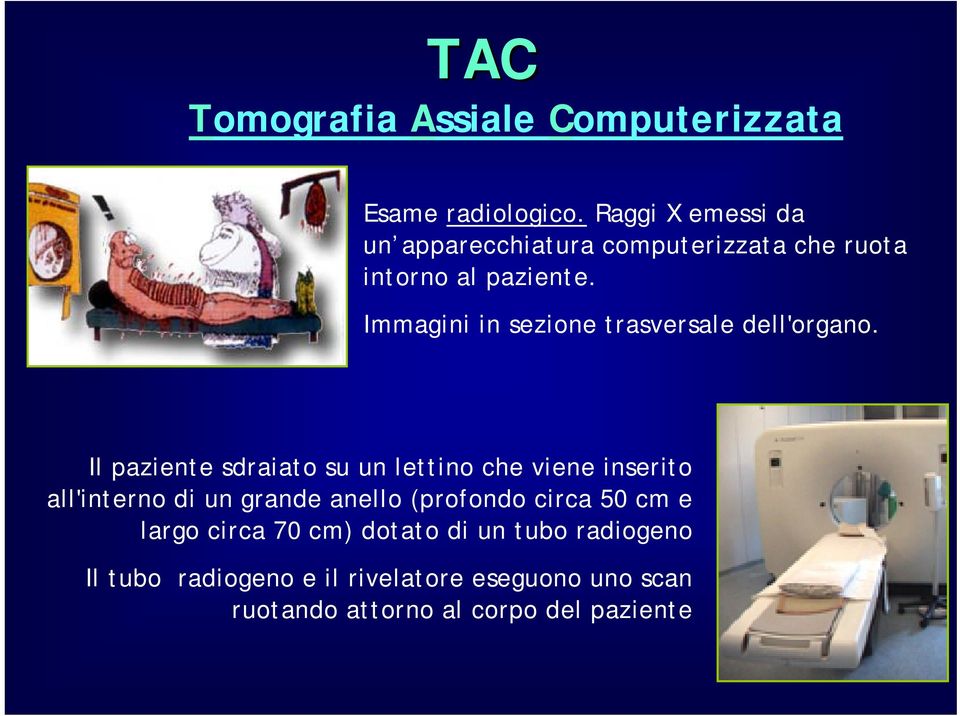 Immagini in sezione trasversale dell'organo.