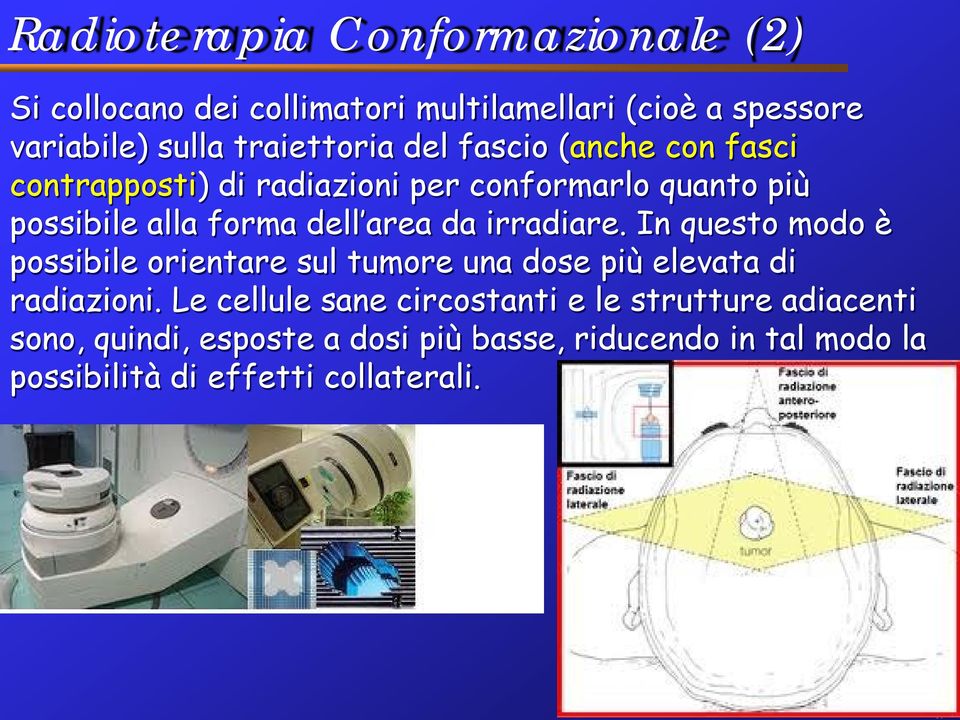 area da irradiare. In questo modo è possibile orientare sul tumore una dose più elevata di radiazioni.