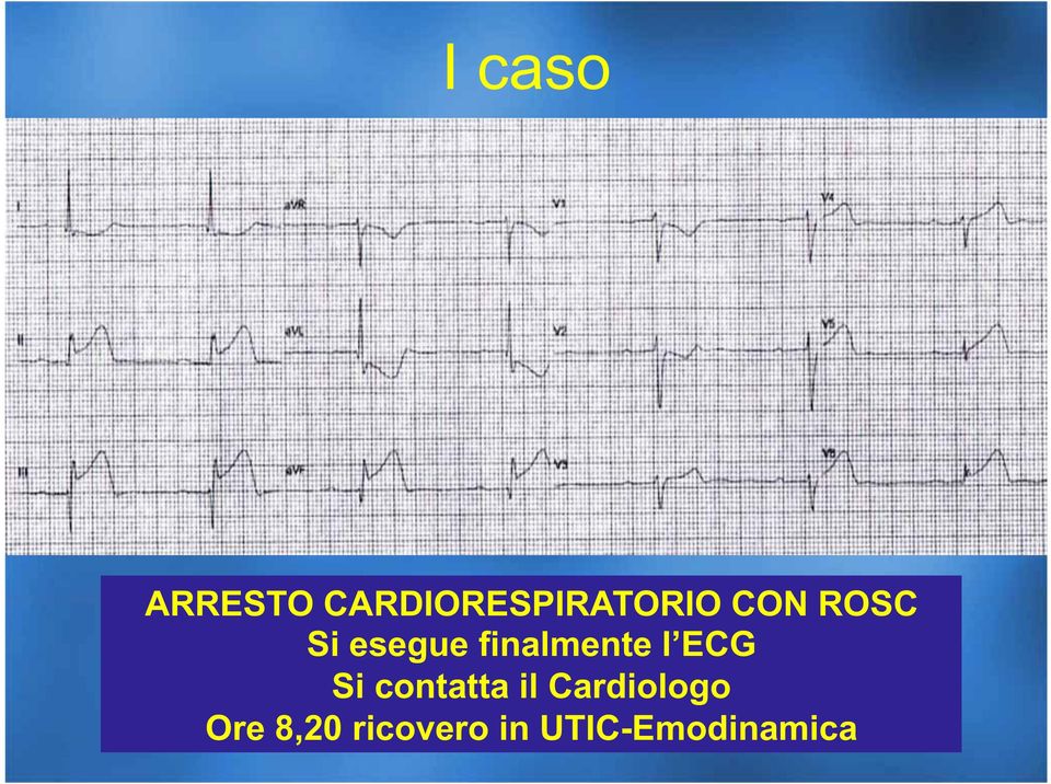 perde conoscenza, con conferma clinica dell arresto cardiaco, viene trasferita immediatamente nell ambulatorio Codici Rossi del Pronto Soccorso, si inizia RCP riscontro di FV al