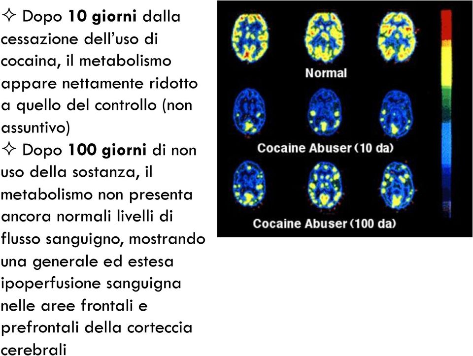 il metabolismo non presenta ancora normali livelli di flusso sanguigno, mostrando una