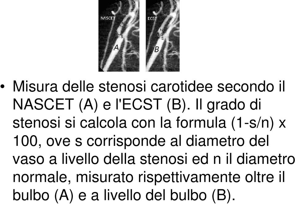 corrisponde al diametro del vaso a livello della stenosi ed n il