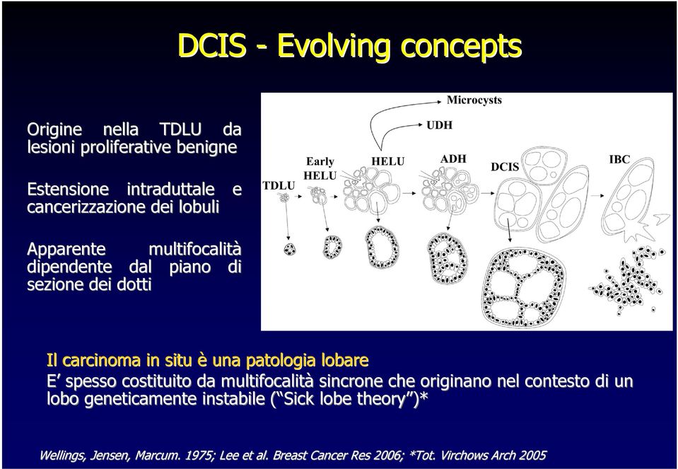 una patologia lobare E spesso costituito da multifocalità sincrone che originano nel contesto di un lobo