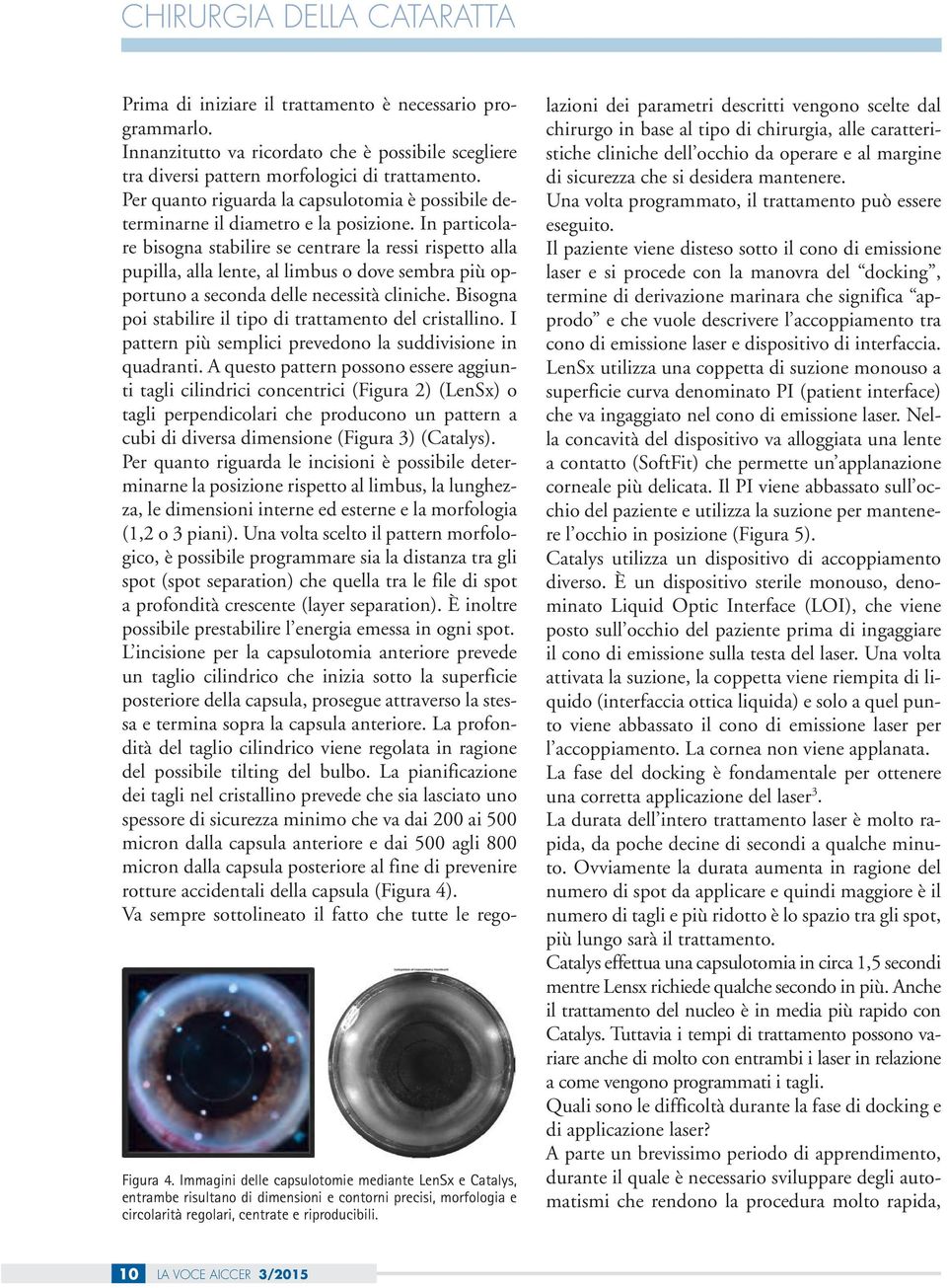 Per quanto riguarda la capsulotomia è possibile determinarne il diametro e la posizione.